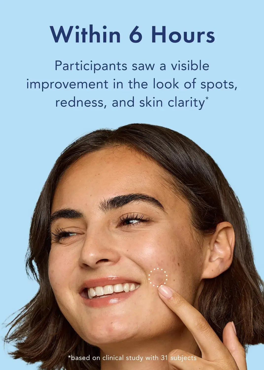 Hydrocolloid Acne Pimple Patches for Face Shrinking Zits Whiteheads Nighttime Spot Pimple Stickers for Face Skin Care Tools