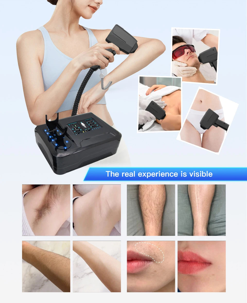 Black 808nm laser hair removal machine for painless, permanent hair reduction and skin rejuvenation with before-after.