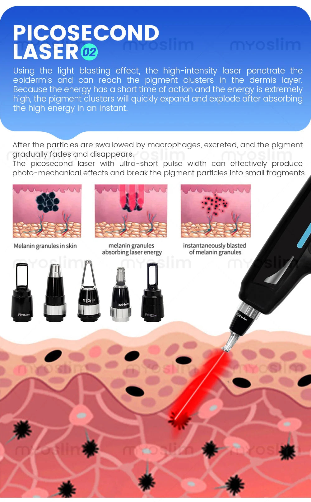 Tidesmit 4 in 1 4500W beauty machine for laser hair removal, tattoo removal, and skin rejuvenation side angle view