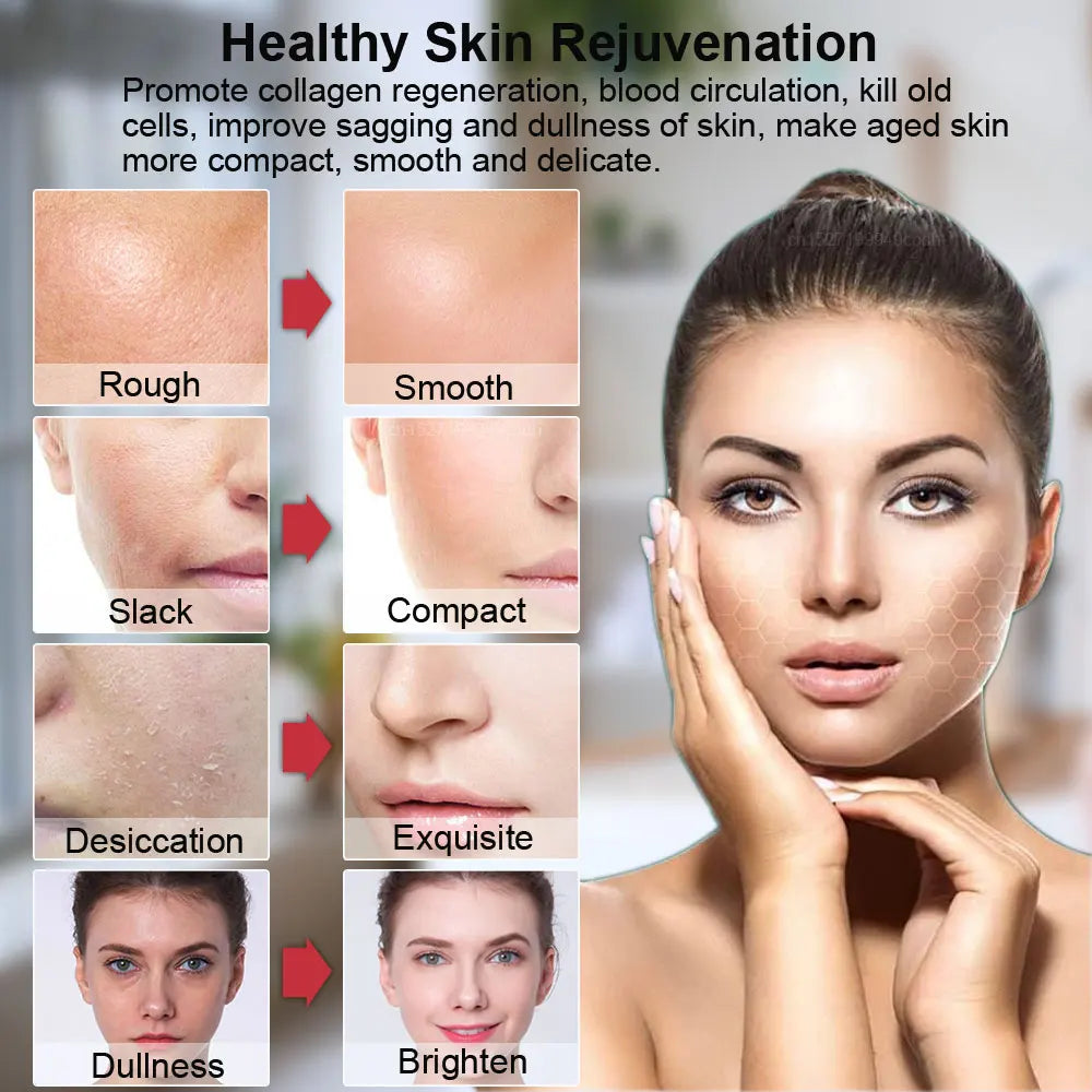 Infographic showing face skin rejuvenation results before and after using a HIFU facial massager.