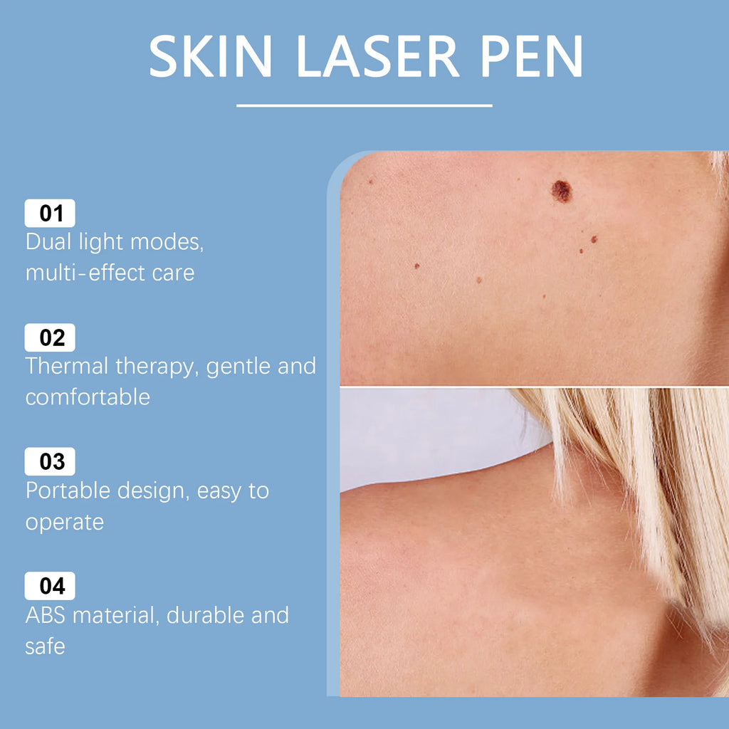 Skin laser pen for removing moles, skin tags, and freckles with portable design, thermal therapy, and dual light modes.