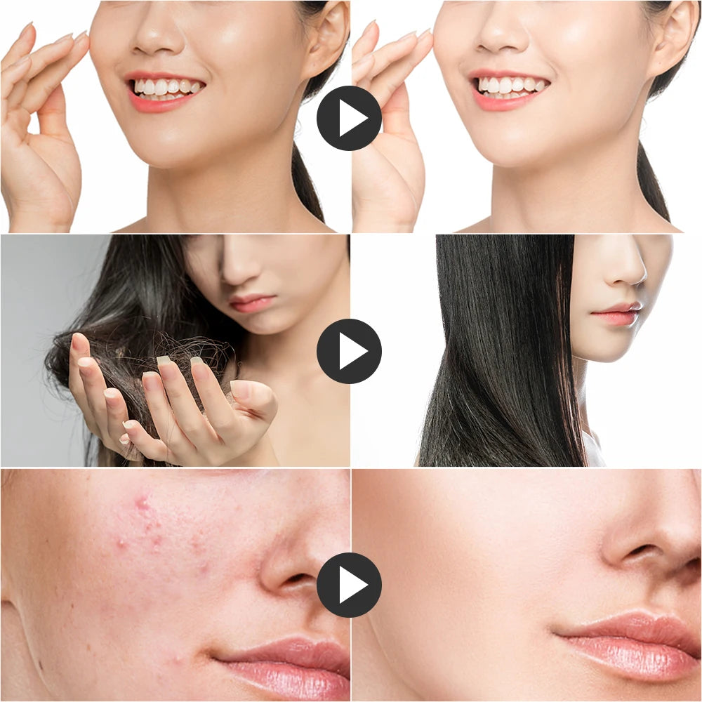 Before and after comparisons showing improved facial skin, reduced hair loss, and clear, acne-free skin.