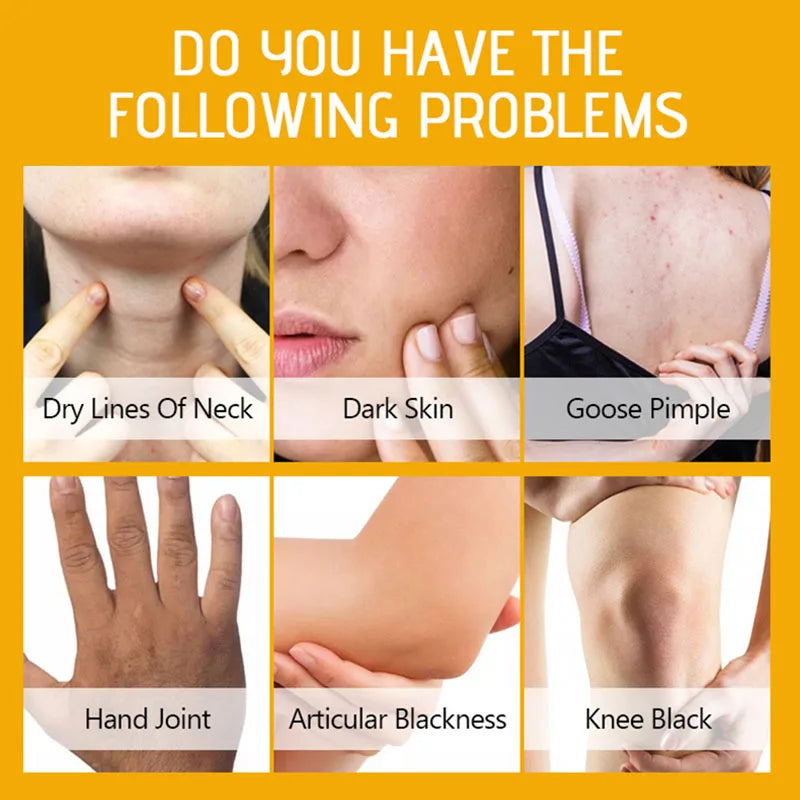 Yellow Peeling Oil for Dark Skin - Professional Exfoliating Treatment Scrubs Treatments Tidesmit