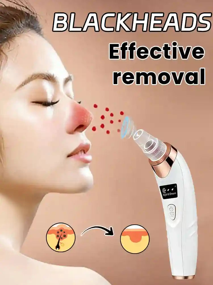 Electric blackhead remover vacuum and acne extractor for deep facial pore cleaning and pimple removal on nose.