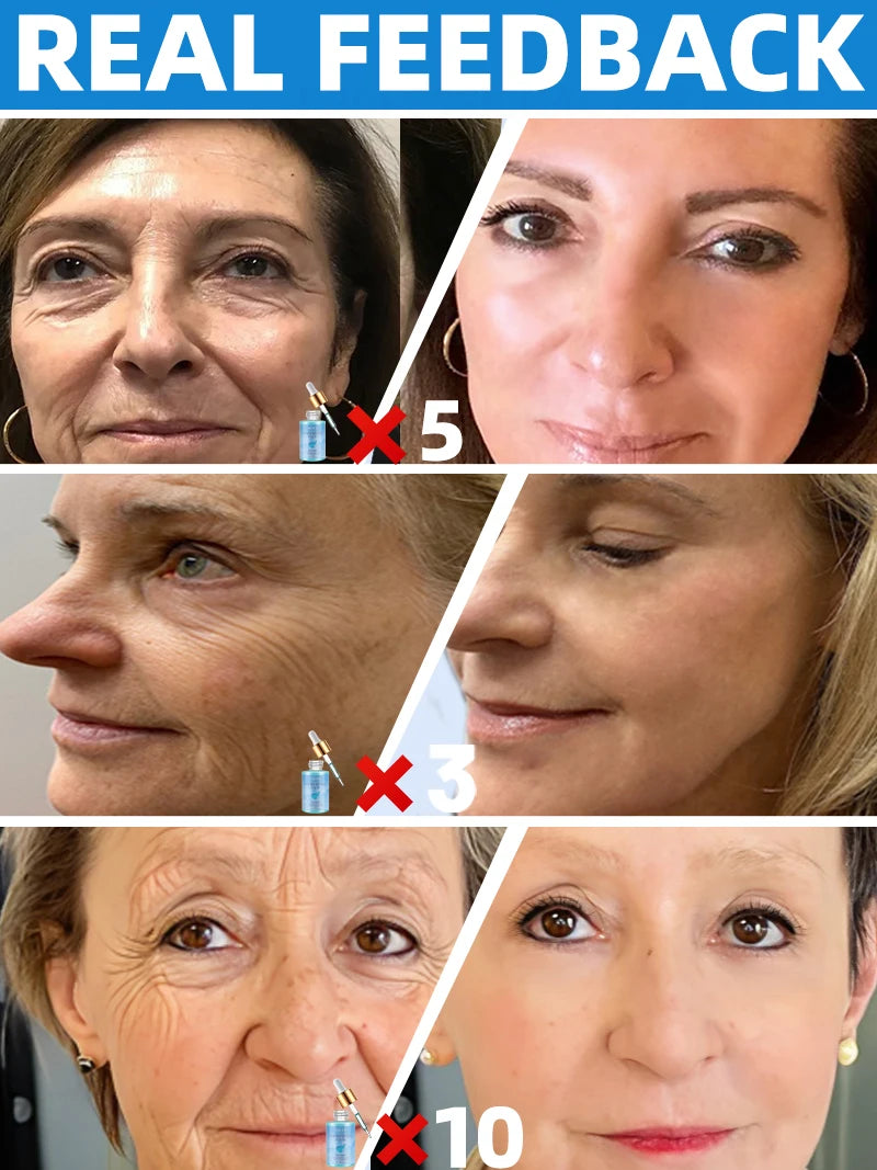 Before-and-after comparison of three women's faces showing reduced wrinkles after using a small blue serum bottle.