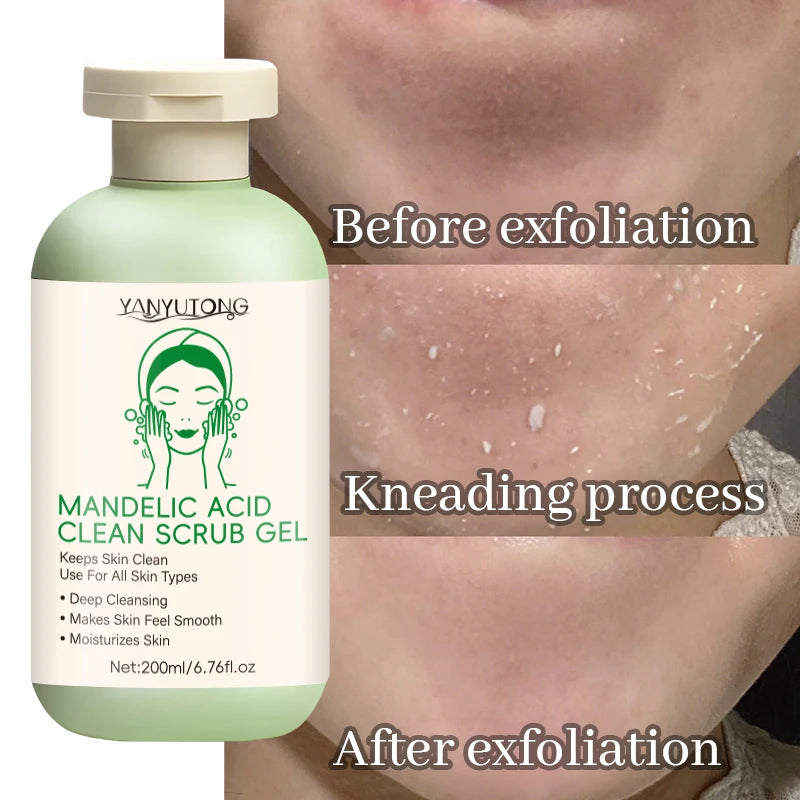 Facial Exfoliating Gel | Deep Pore Cleansing & Oil Control 200ml Scrubs Treatments Tidesmit