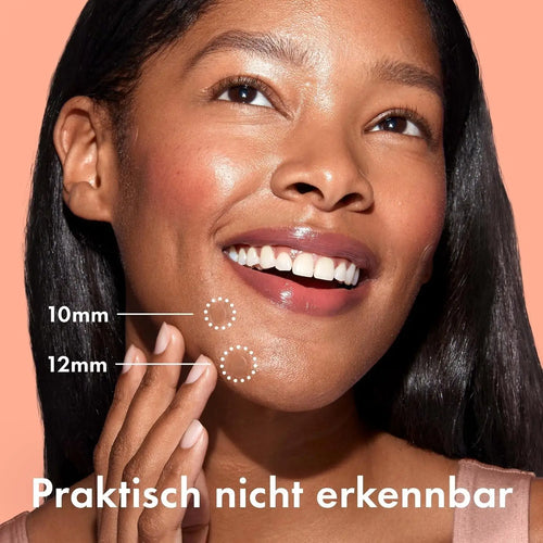 Acne pimple patch being placed on skin; small round hydrocolloid dots near cheek
