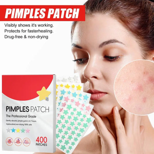 Acne pimple cover patches with colorful star stickers and box for discreet spot treatment
