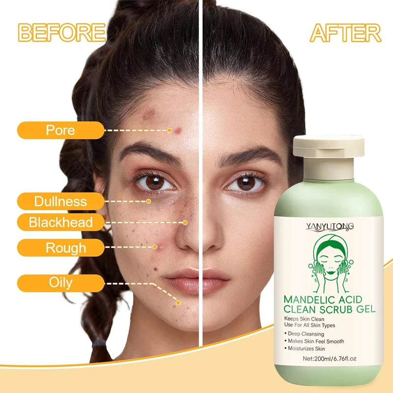 Facial Exfoliating Gel | Deep Pore Cleansing & Oil Control 200ml Scrubs Treatments Tidesmit