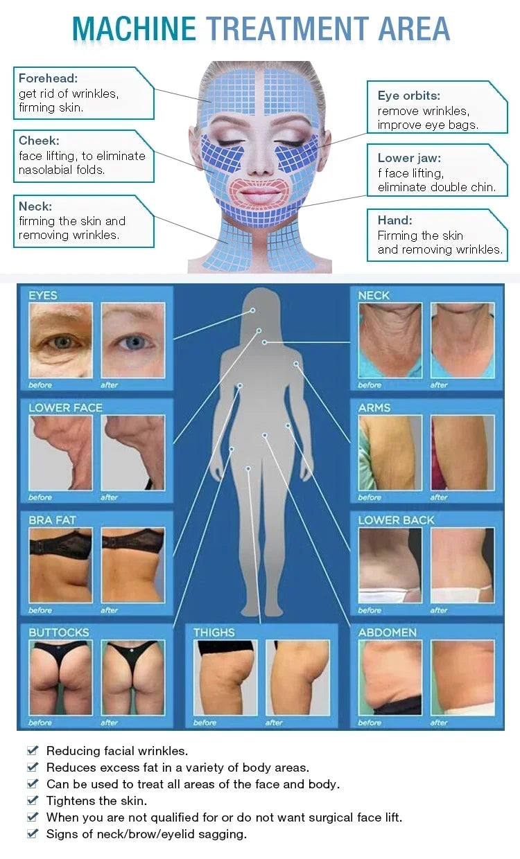 Ultra 360 body contouring and anti-aging device chart showing before and after face, skin tightening, and fat reduction.