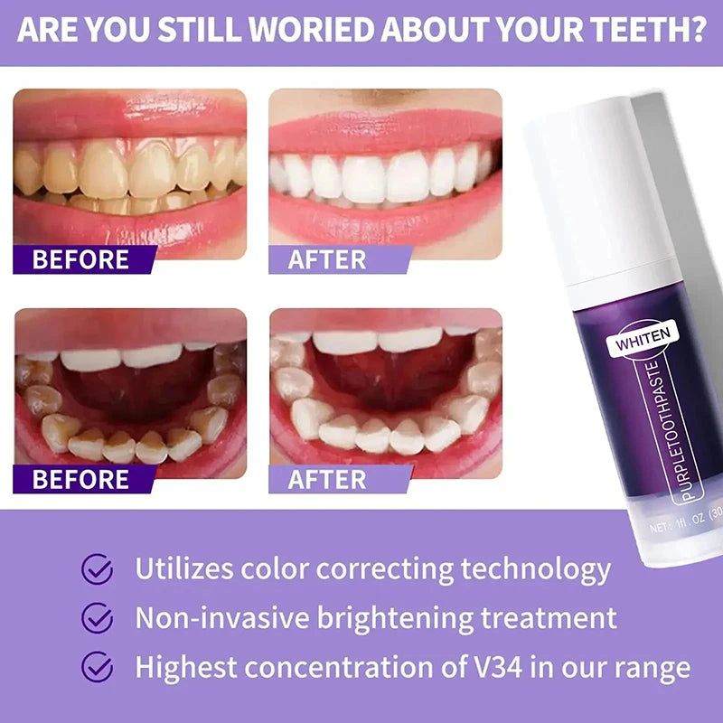 Tidesmit 5D teeth whitening toothpaste and stick for professional oral hygiene and fresh breath cleaning.