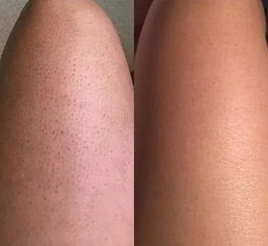 Fig Sugar Body Scrub Exfoliating Moisturizer - Natural Smoothing Care Scrubs Treatments Tidesmit