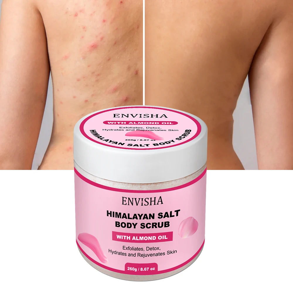 Rose Body Scrub - Natural Exfoliating Moisturizer for Smooth Skin Scrubs Treatments Tidesmit