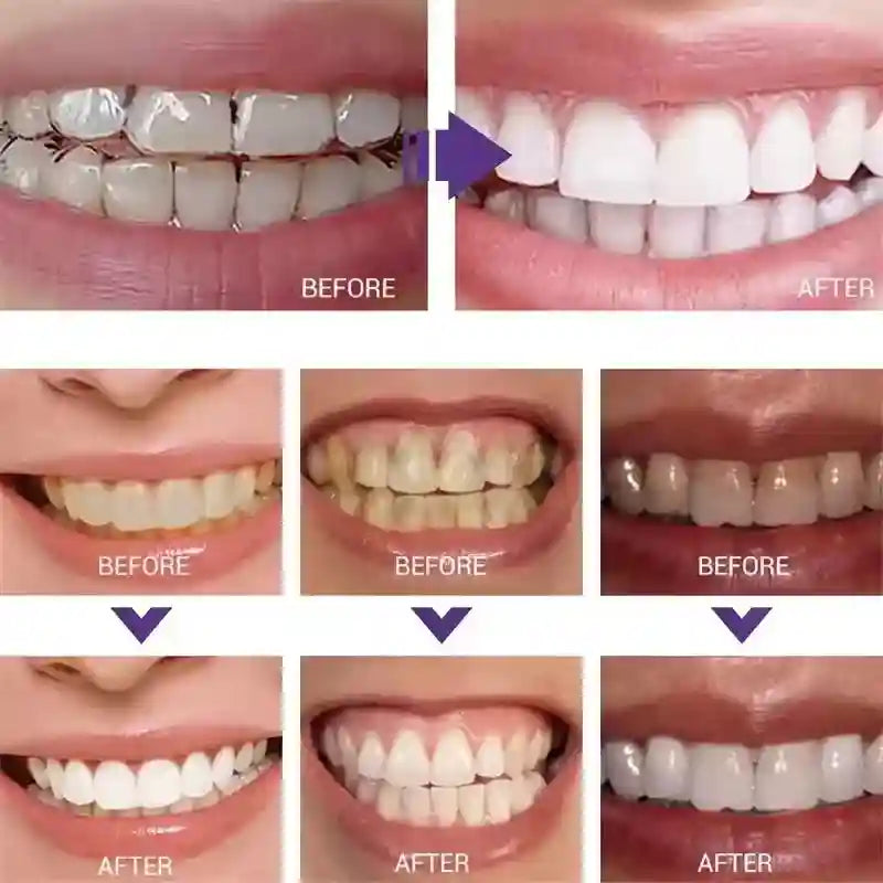 Tidesmit teeth whitening toothpaste and portable whitening stick for professional oral hygiene and fresh breath.