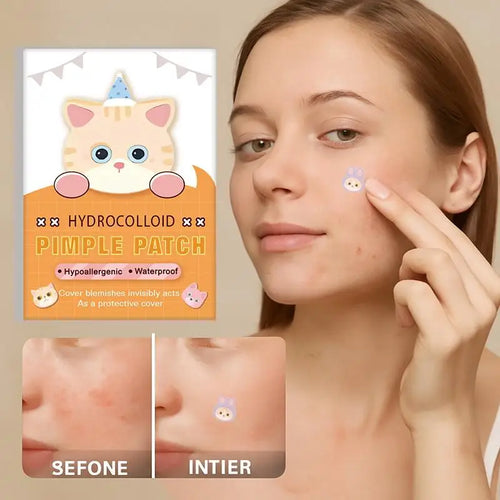 Cat-shaped hydrocolloid pimple patch being applied near the cheek, with patch package