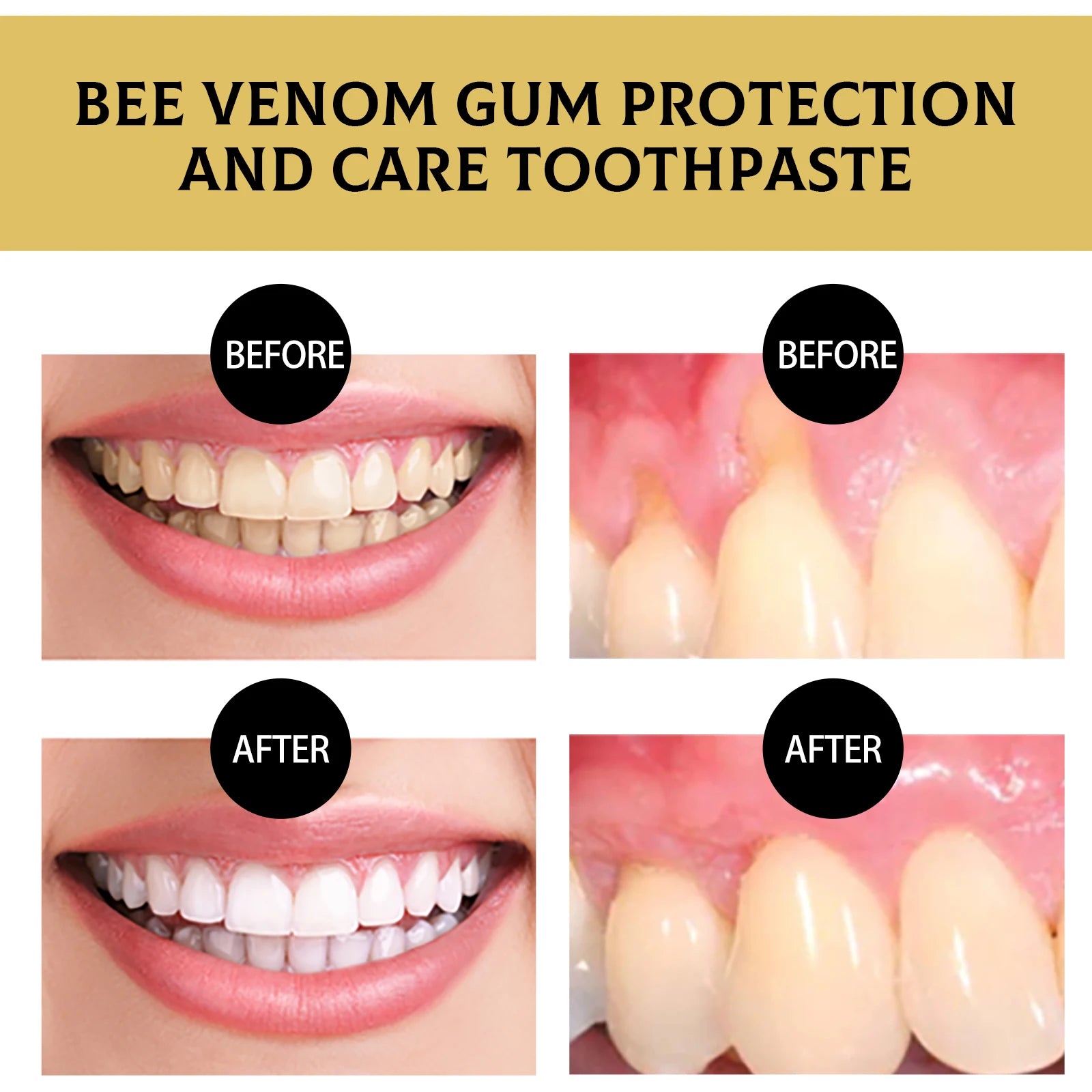 Tidesmit Bee Venom teeth whitening toothpaste for plaque removal and long-lasting fresh breath oral care.