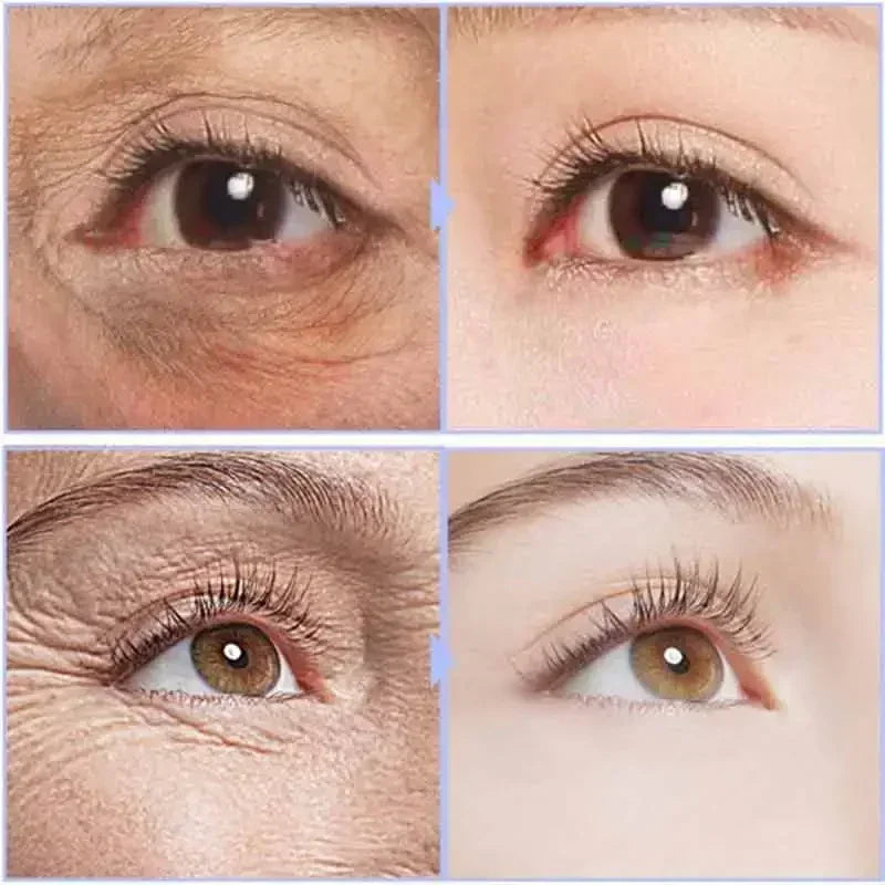 Instant Anti Aging Eye Cream for Dark Circles and Puffiness | Tidesmit Relaxation Treatment Tidesmit