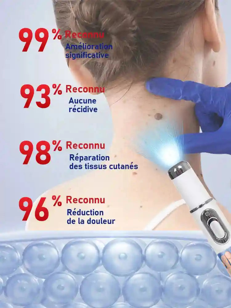 Wart Remover Laser Roller - 7-Day Precision Skin Treatment Tool Massage Roller Tidesmit