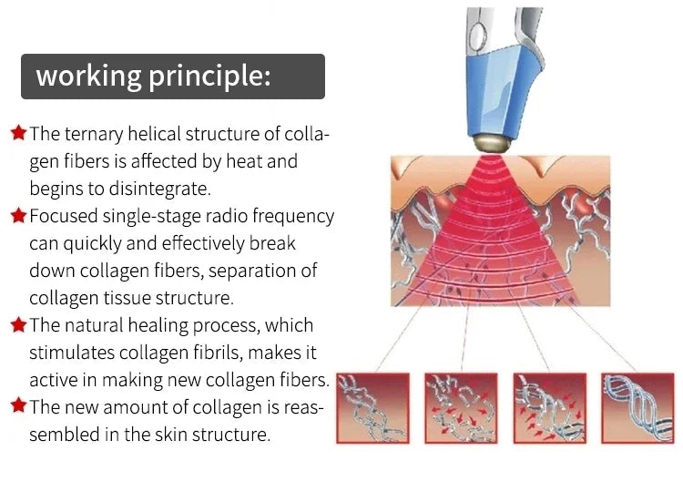 Professional Skin Tightening Machine for Face Lifting and Fat Removal Relaxation Treatment Tidesmit