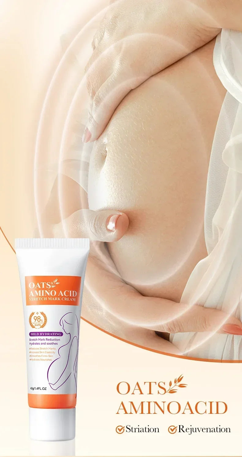 Stretch Marks Permanent Removal Cream Eliminate Body Belly Stretch Marks Swelling Marks Remove Skin Cracks Repair Firming Care