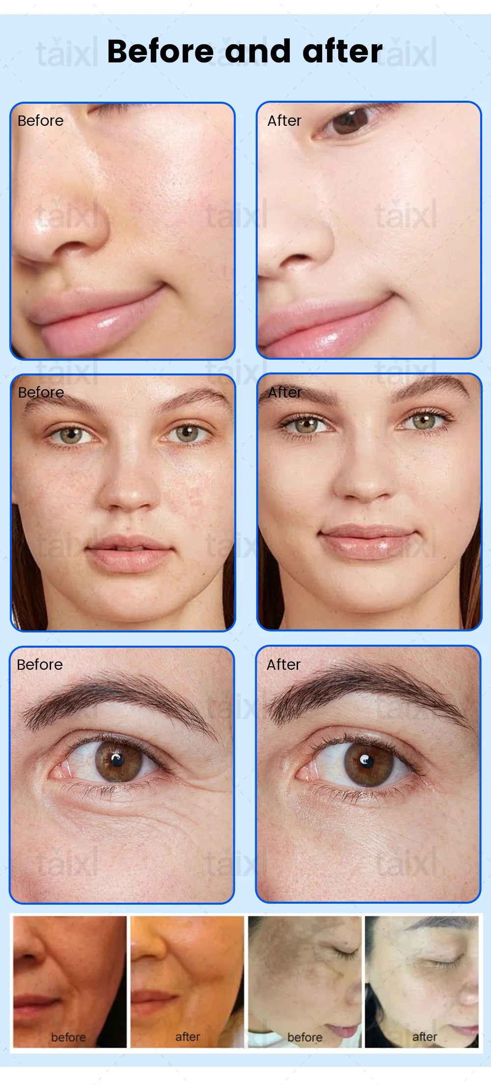 Tidesmit 8-in-1 medical grade plasma therapy device for pigmentation removal and hot cold facial treatment side view