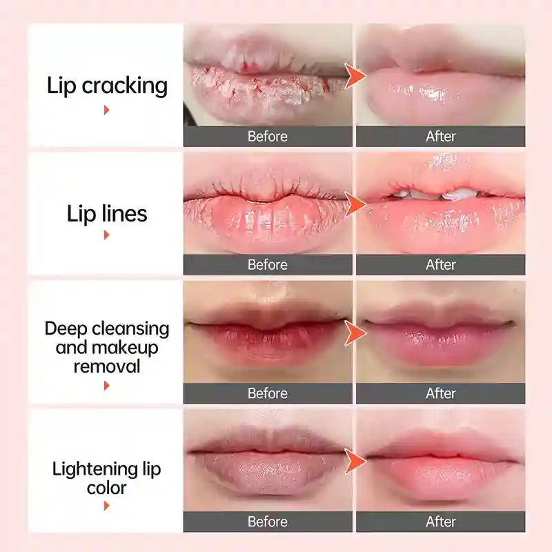 Pink Lip Lightening Serum for Dark Lips - Moisturizing Lip Care Lip Care Tidesmit