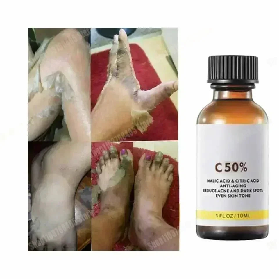 Salicylic Acid Face Peel - Professional Deep Exfoliation & Skin Refinement Scrubs Treatments Tidesmit