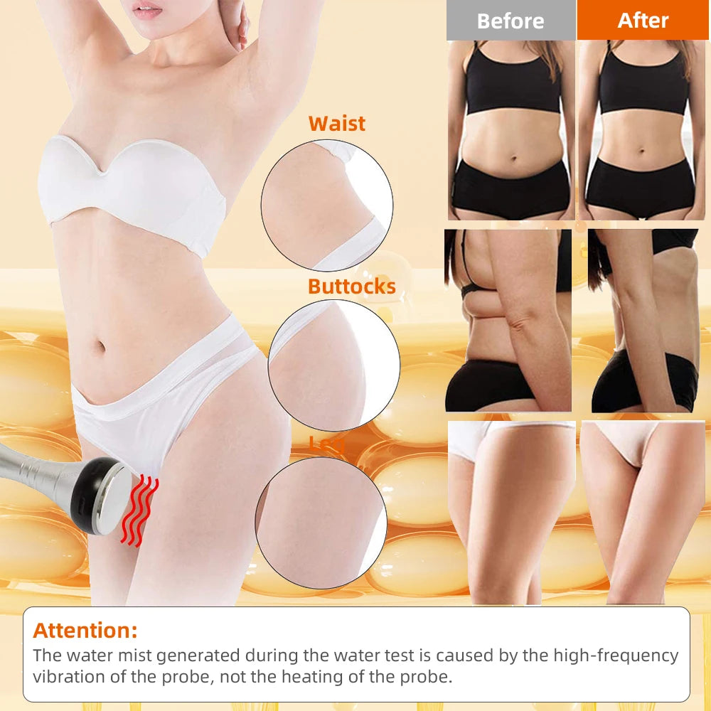 40K Cavitation Body Slimming Machine for Targeted Skin Tightening Body Shaping Massage Equipment Tidesmit