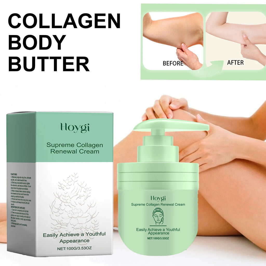 Hoygi Collagen Body Lotion for Dry Skin Hydrating Firming Cream with Niacinamide Smooth Skin Daily Moisturizer for Women 100g