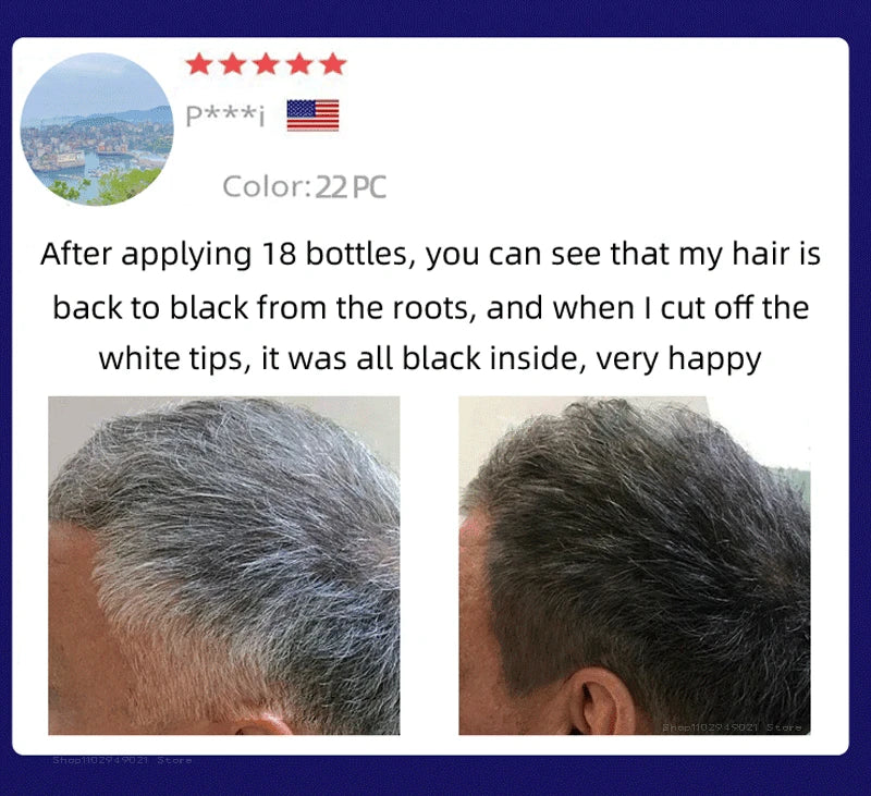 Anti Gray Hair Serum – Natural Scalp Nourishing Darkening Care Lip Care Tidesmit