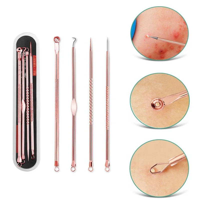 4Pcs/set Black Dots Cleaner Needles Acne Blemish Remover Blackhead Extractor Skin Care Blackhead Remover Tool Stainless Steel