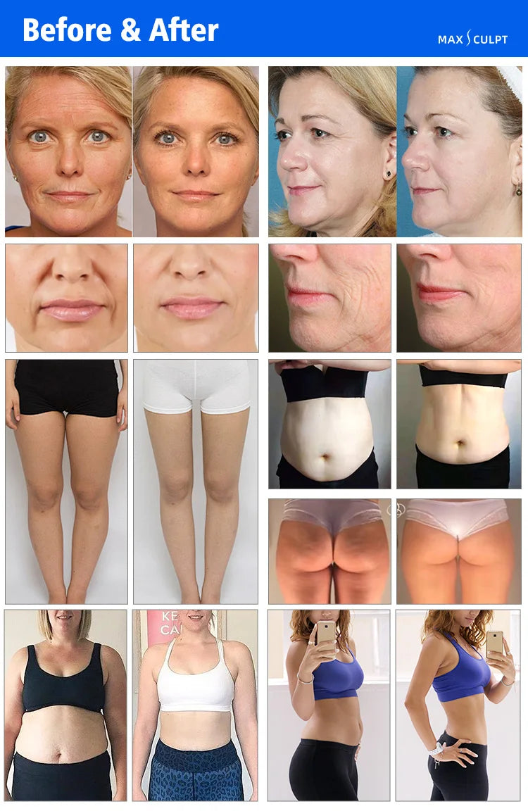 Body Shaping Cavitation Machine for Professional Slimming and Firming Body Shaping Massage Equipment Tidesmit