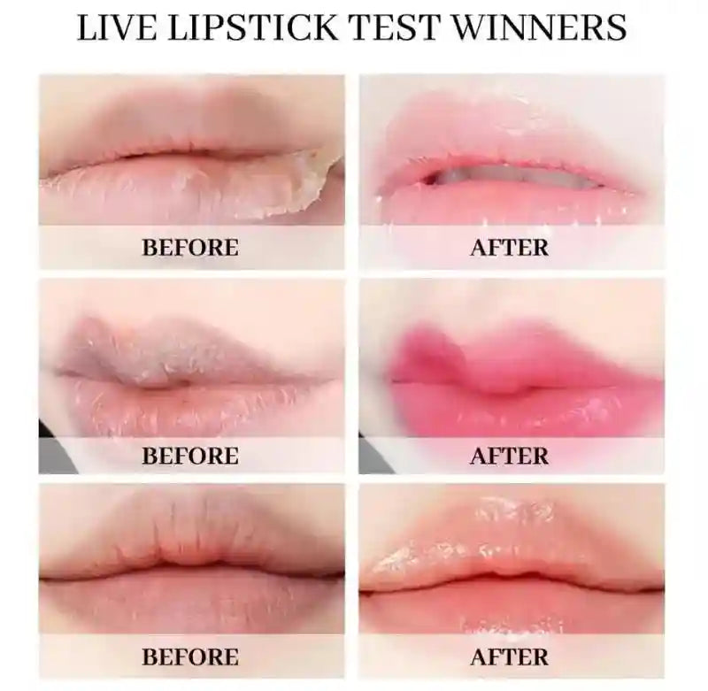 Dark Lip Lightening Serum - Exfoliating Lip Repair Balm by Tidesmit Lip Care Tidesmit