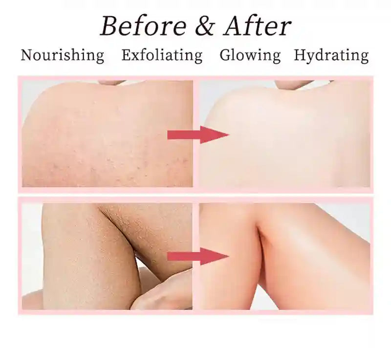 Shea Butter Body Scrub: Exfoliating & Moisturizing Treatment Scrubs Treatments Tidesmit