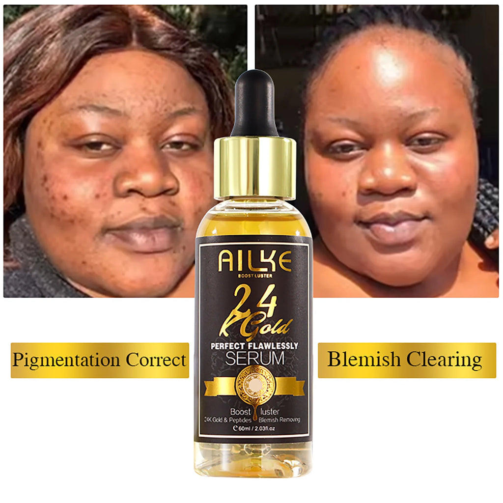 AILKE 24k Gold Flawlessly Whitening Skin Care Set For All Skin Type, Moisturizer, Reduce Black Spots, Smoothing, Brightening