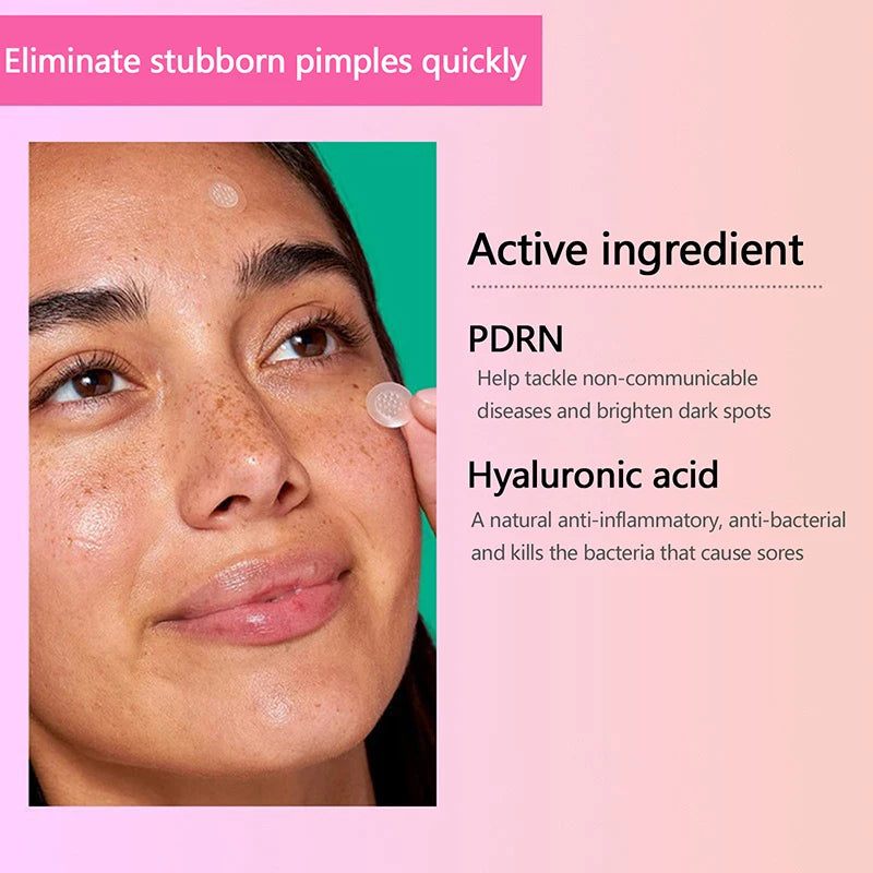 Salicylic AcidRemoval Acne Stickers Microneedle Blemish Treatment Facial Healing Treatment Skin Care Patch Tools Water-Soluble