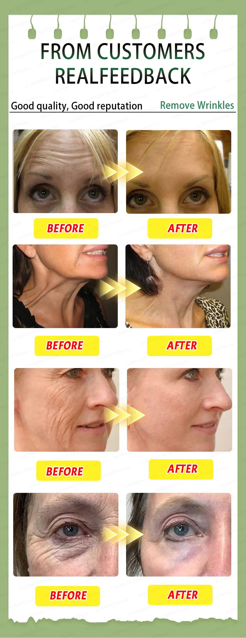 Tidesmit anti-aging supplement before and after results: effectively reduces wrinkles and improves skin elasticity.