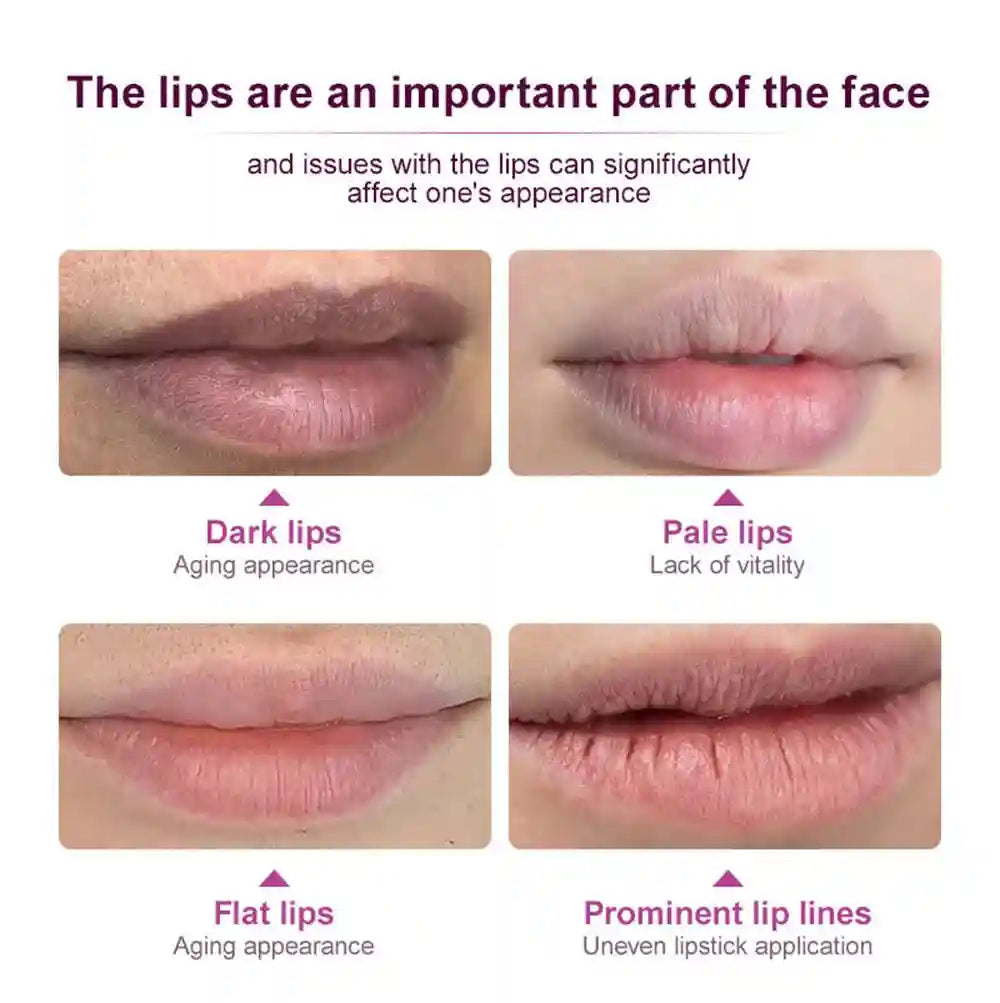 Lip Lightening Balm - Exfoliating Moisturizer for Dark Lips | Tidesmit Lip Care Tidesmit