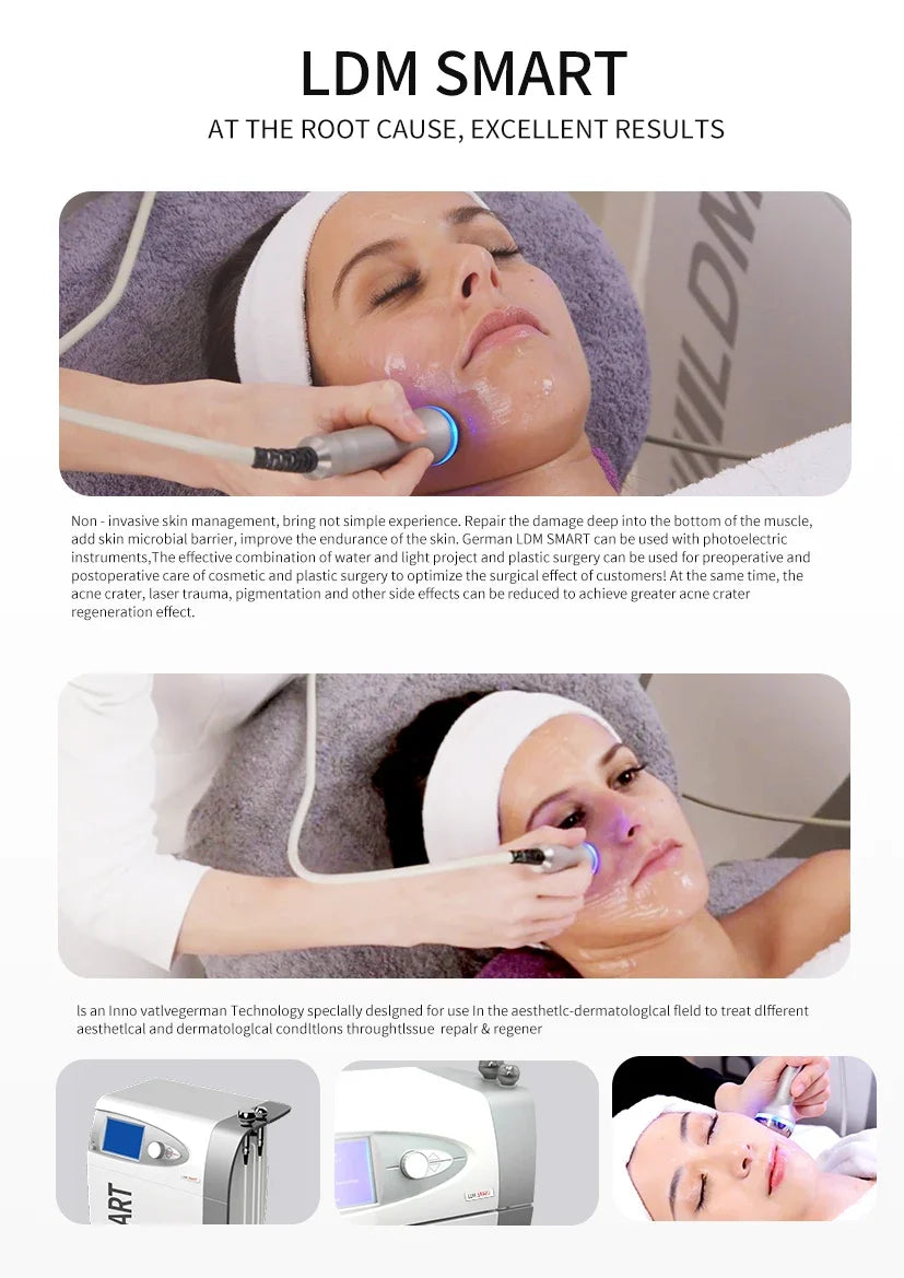 LDM Smart beauty machine for professional face lifting, wrinkle removal, and collagen rejuvenation treatment.