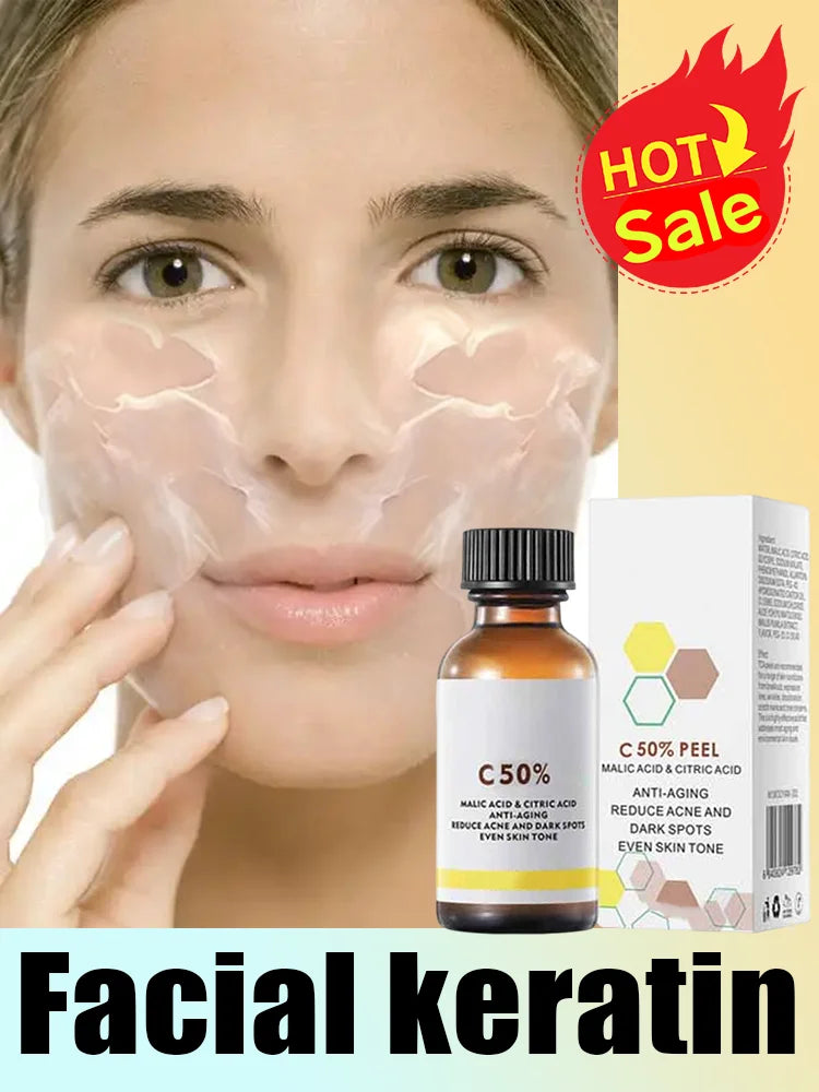 Acid Peeling Serum Chemical Exfoliant Peel for remove Face Dark Skin Spots Whiten Lighten Melanin Peeling Solution Skin Peel