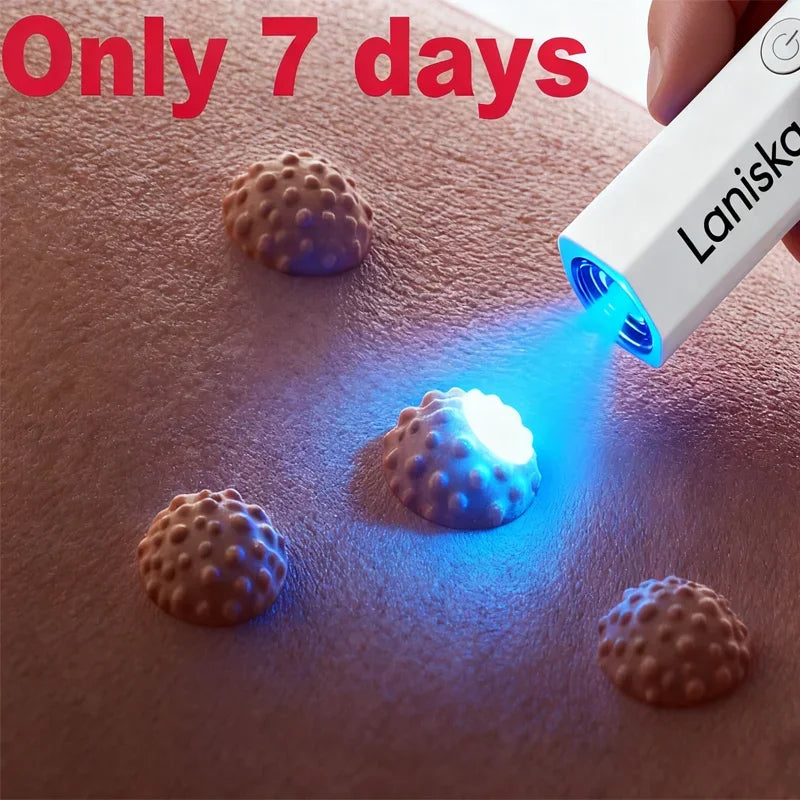 Tidesmit 2nd generation wart remover for face makeup application to quickly repair and treat warts from the root
