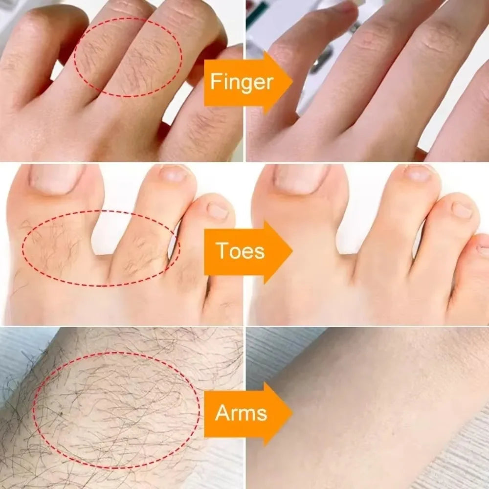 Fast Hair Removal Cream | Painless Depilatory for Face and Body Lip Care Tidesmit