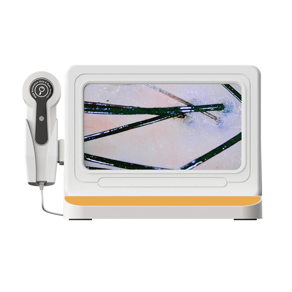 White digital scalp microscope and hair analyzer with 10-inch HD display screen showing magnified hair follicles.