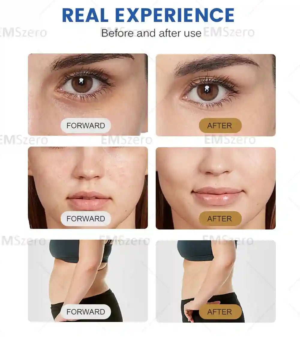 7D HIFU Skin Tightening Machine for Facial Lifting | Tidesmit Eye Massage Instrument Tidesmit