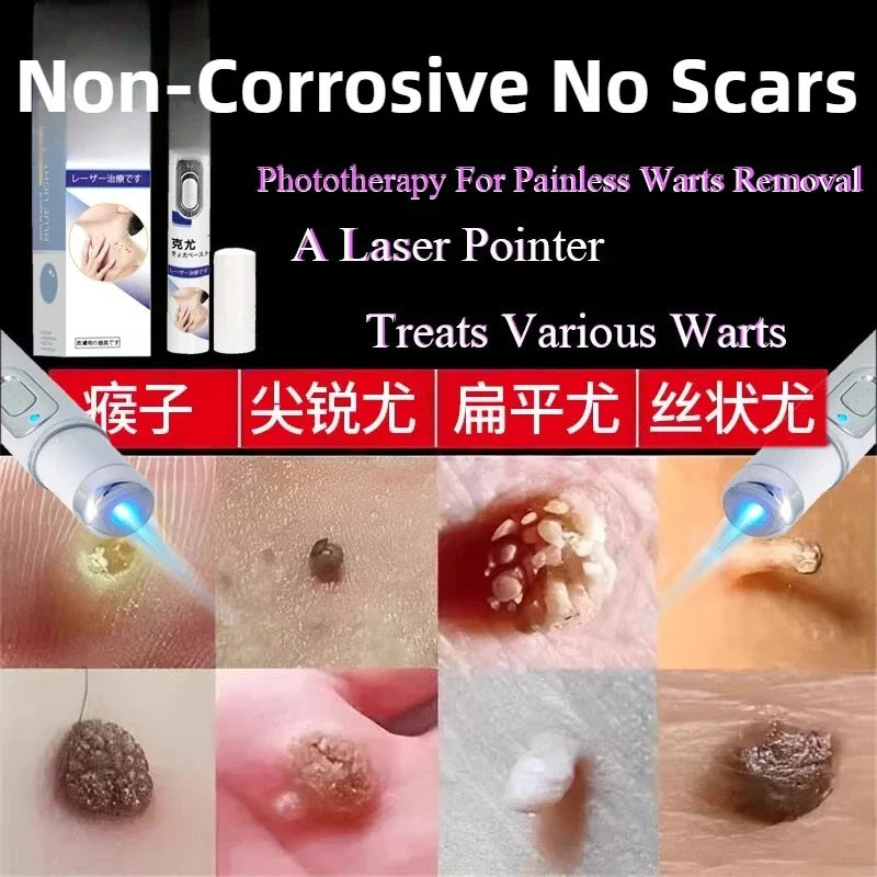 Professional PMU Machine - Precision Skin Tag & Wart Removal Pen Permanent Makeup Machines Tidesmit