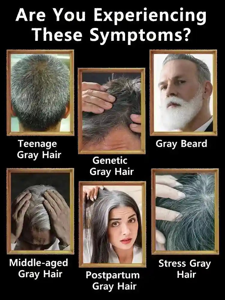 Anti-Gray Hair Serum: Natural Color Repair Treatment for Hair Health Lip Care Tidesmit