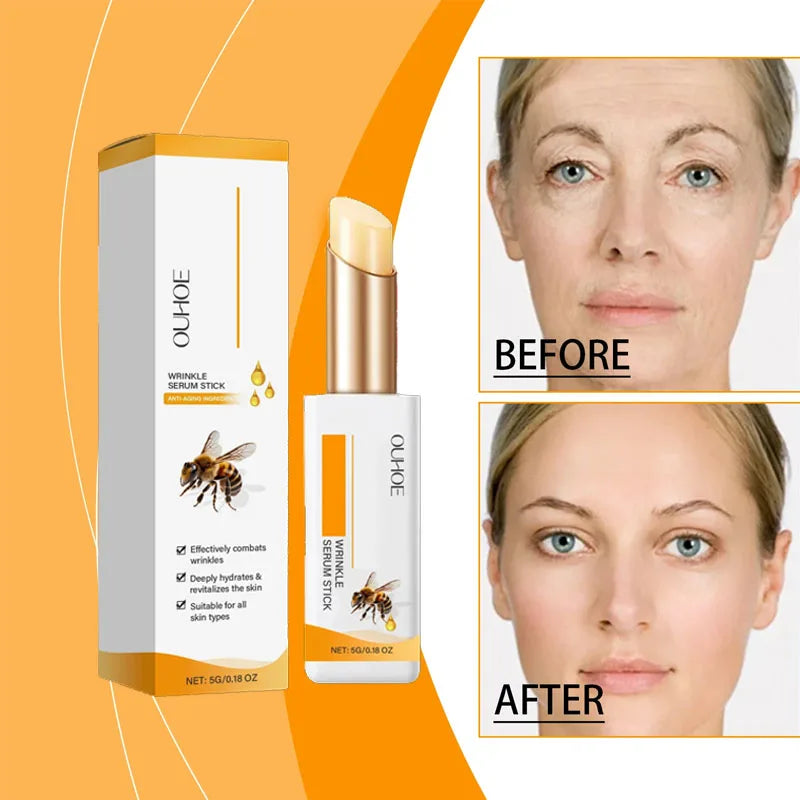Anti Wrinkle Eye Cream for Dark Circles and Puffiness | Tidesmit EU Scrubs Treatments Tidesmit