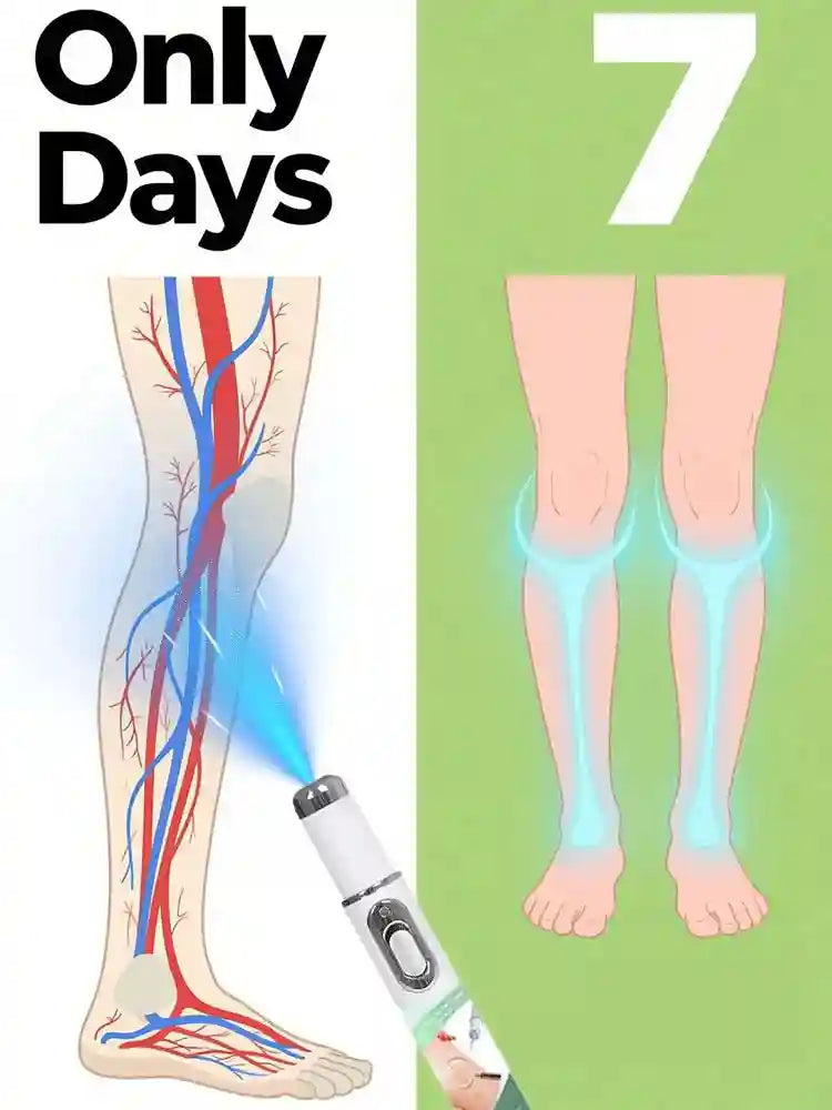 Portable blue light laser device for spider veins and varicose leg treatment shown in a 7-day before-after comparison.