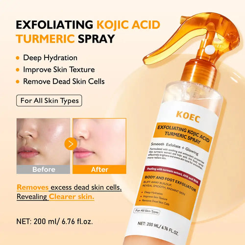 KOEC anti-inflammatory turmeric spray for skin, 200ml, in a clear bottle with an orange nozzle and label.