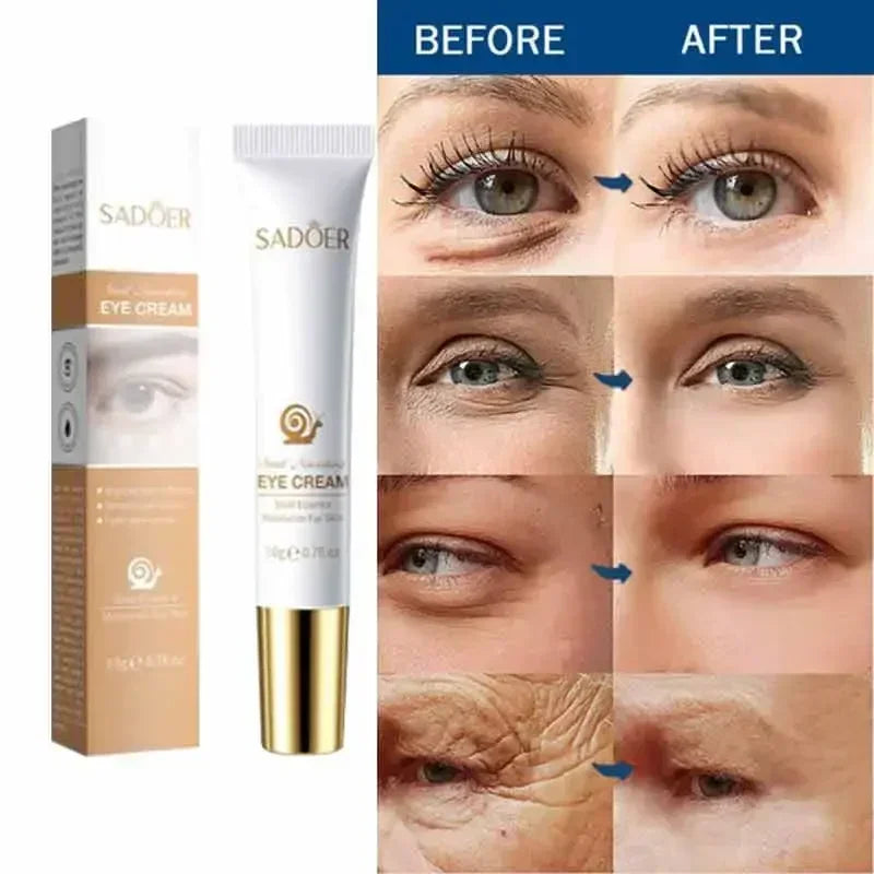 Anti Aging Eye Cream for Dark Circles & Puffiness - Tidesmit EU Scrubs Treatments Tidesmit
